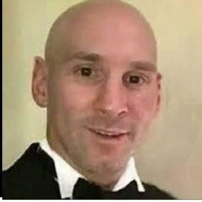 Imagem do grupo Meçi careca